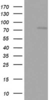 Western Blot: OAS2 Antibody (6E6) [NBP2-46293] - Analysis of HEK293T cells were transfected with the pCMV6-ENTRY control (Left lane) or pCMV6-ENTRY OAS2.