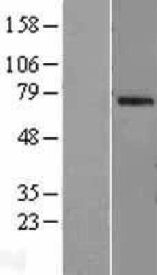 Western Blot OAS2 Overexpression Lysate