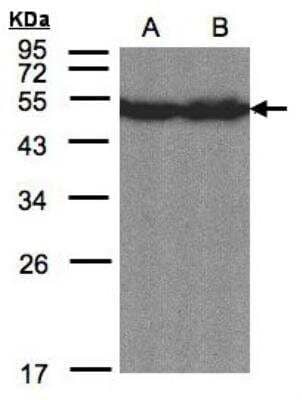 Western Blot: OASIS/CREB3L1 Antibody [NBP1-31017] - Sample(30 ug of whole cell lysate)A:Hep G2 B:MOLT4 12% SDS PAGE, antibody diluted at 1:1500.