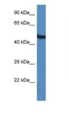 Western Blot: OASL Antibody [NBP1-91626] - Titration: 1.0 ug/ml Positive Control: Mouse Brain.