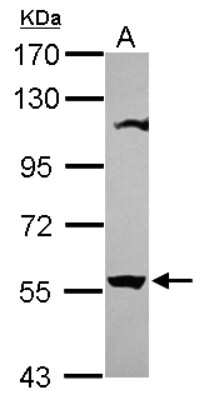 Western Blot: OASL Antibody [NBP2-19619] - Sample (30 ug of whole cell lysate) A: U87-MG 7. 5% SDS PAGE gel, diluted at 1:1000.