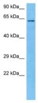 Western Blot OASL2 Antibody