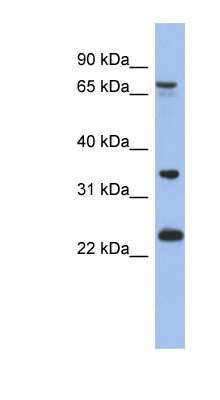 Western Blot: OATL1 Antibody [NBP1-56840] - 721_B cell lysate, concentration 0.2-1 ug/ml.