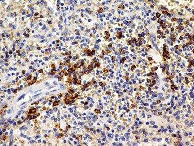 Immunohistochemistry-Paraffin: OATP1B3/SLCO1B3/OATP8 Antibody (1E6.2F9) [NBP2-36492] - Analysis of formalin-fixed paraffin-embedded tissue section of normal human spleen using mouse monoclonal OATP1B3/SLCO1B3/OATP8 antibody (clone 1E6.2F9) at 5 ug/ml concentration.