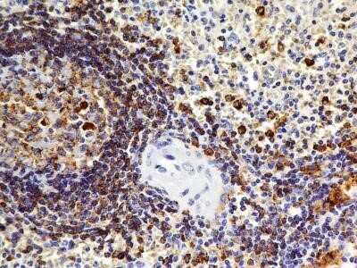 Immunohistochemistry: OATP1B3/SLCO1B3/OATP8 Antibody (1F6.1B1) - Azide and BSA Free [NBP2-80889] - Analysis of formalin-fixed paraffin-embedded tissue section of normal human spleen using mouse monoclonal OATP1B3/SLCO1B3/OATP8 antibody (clone 1F6.1B1) at 5 ug/ml concentration. Image from the standard format of this antibody.