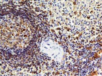 Immunohistochemistry-Paraffin: OATP1B3/SLCO1B3/OATP8 Antibody (1F6.1B1) [NBP2-36493] - Analysis of formalin-fixed paraffin-embedded tissue section of normal human spleen using mouse monoclonal OATP1B3/SLCO1B3/OATP8 antibody (clone 1F6.1B1) at 5 ug/ml concentration.
