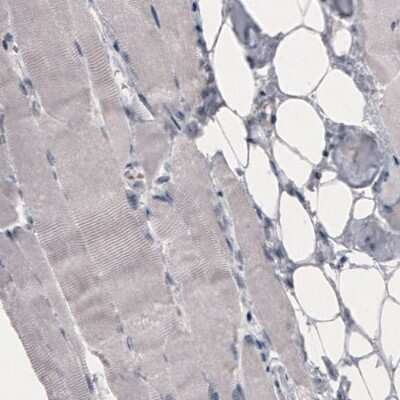 Immunohistochemistry-Paraffin: OATP1B3/SLCO1B3/OATP8 Antibody (CL3771) [NBP2-61637] - Staining of human skeletal muscle shows absence of immunoreactivity (negative control).