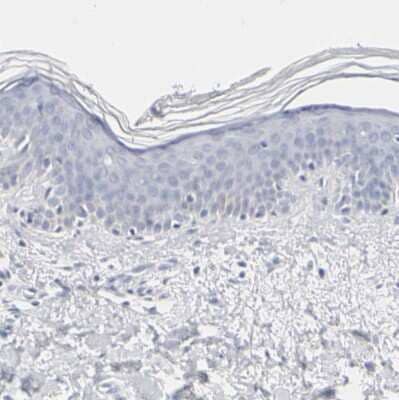 Immunohistochemistry-Paraffin: OATP1B3/SLCO1B3/OATP8 Antibody [NBP1-80980] - Staining of human skin shows no positivity in squamous epithelial cells as expected.