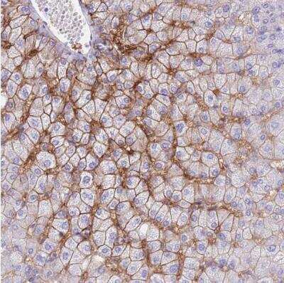 Immunohistochemistry-Paraffin: OATP1B3/SLCO1B3/OATP8 Antibody [NBP2-54739] - Staining of human liver shows moderate membranous positivity in hepatocytes.