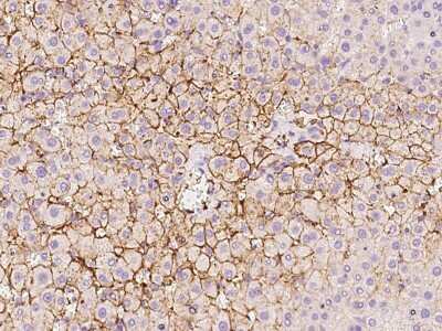 Immunohistochemistry-Paraffin: OATP1B3/SLCO1B3/OATP8 Antibody [NBP2-98474] - Immunochemical staining of human OATP1B3/SLCO1B3/OATP8 in human liver with rabbit polyclonal antibody at 1:100 dilution, formalin-fixed paraffin embedded sections.