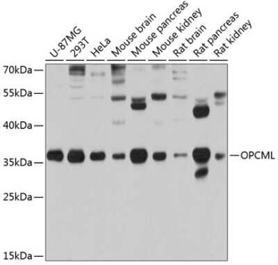 Western Blot: OBCAM/OPCML Antibody [NBP2-94011] - Analysis of extracts of various cell lines, using OBCAM/OPCML at 1:1000 dilution.Secondary antibody: HRP Goat Anti-Rabbit IgG (H+L) at 1:10000 dilution.Lysates/proteins: 25ug per lane.Blocking buffer: 3% nonfat dry milk in TBST.Detection: ECL Basic Kit .Exposure time: 10s.