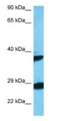 Western Blot: OBCAM/OPCML Antibody [NBP3-09427] - Western blot analysis of OBCAM/OPCML in Rat Liver. Antibody dilution at 1.0ug/ml