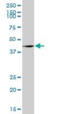 Western Blot: OBFC1 Antibody [H00079991-B01P] - Analysis of OBFC1 expression in human spleen.