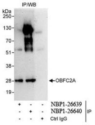 Immunoprecipitation: OBFC2A Antibody [NBP1-26640] - Whole cell lysate (1 mg for IP, 20% of IP loaded) from HeLa cells. Antibodies: Affinity purified rabbit used for IP at 10 mcg/mg lysate.