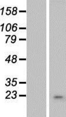 Western Blot: OBFC2A Overexpression Lysate (Adult Normal) [NBP2-08591] Left-Empty vector transfected control cell lysate (HEK293 cell lysate); Right -Over-expression Lysate for OBFC2A.