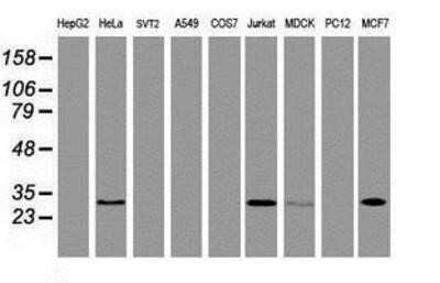 Western Blot: OBFC2B Antibody (OTI1E11) - Azide and BSA Free [NBP2-73140] - Analysis of extracts (35ug) from 9 different cell lines by using anti-OBFC2B monoclonal antibody.