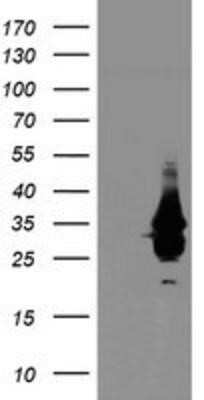Western Blot: OBFC2B Antibody (OTI1E11) - Azide and BSA Free [NBP2-73140] - HEK293T cells were transfected with the pCMV6-ENTRY control (Left lane) or pCMV6-ENTRY OBFC2B (Right lane) cDNA for 48 hrs and lysed. Equivalent amounts of cell lysates (5 ug per lane) were separated by SDS-PAGE and immunoblotted with anti-OBFC2B.
