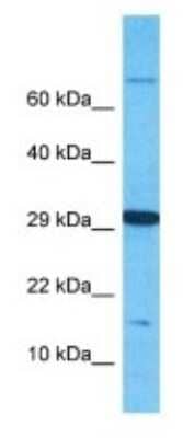 Western Blot: OBP2B Antibody [NBP3-09756] - Western blot analysis of OBP2B in 786-0 Whole Cell lysates. Antibody dilution at 1.0ug/ml