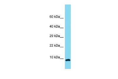 Western Blot: OCC1 Antibody [NBP2-83302] - Host: Rabbit. Target Name: C12orf75. Sample Type: NCI-H226 Whole Cell lysates. Antibody Dilution: 1.0ug/ml