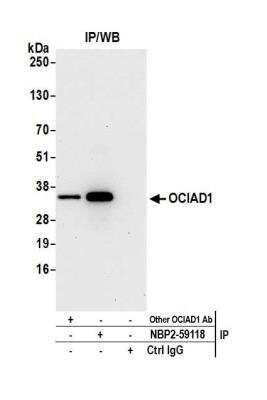 OCIAD1 Antibody [NBP2-59118] - Detection of human OCIAD1 by western blot of immunoprecipitates. Samples: Whole cell lysate (0.5 or 1.0 mg per IP reaction; 20% of IP loaded) from 293T cells prepared using NETN lysis buffer. Antibodies: Affinity purified rabbit anti-OCIAD1 antibody NBP2-59118 used for IP at 8 ul per reaction. OCIAD1 was also immunoprecipitated by another rabbit anti-OCIAD1 antibody. Detection: Chemiluminescence with an exposure time of 30 seconds.