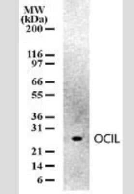 Western Blot: OCIL/CLEC2d Antibody (166C1309) [NB100-56553] - Analysis of OCIL in mouse spleen cell lysates. Thirty microgram of cell lysates per lane of mini gel.