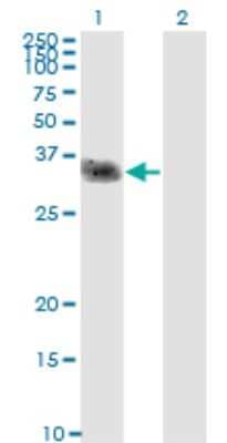 Western Blot: OCIL/CLEC2d Antibody (4C7) [H00029121-M01] - Analysis of CLEC2D expression in transfected 293T cell line by CLEC2D monoclonal antibody (M01), clone 4C7.Lane 1: CLEC2D transfected lysate(21.8 KDa).Lane 2: Non-transfected lysate.