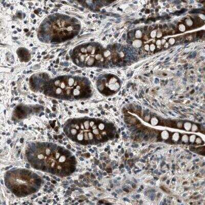 Immunohistochemistry-Paraffin: OCIL/CLEC2d Antibody [NBP1-84455] - Staining of human colon shows strong positivity in glandular cells.