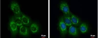 Immunocytochemistry/Immunofluorescence: OCRL Antibody [NBP2-19621] - A431 cells were fixed in ice-cold MeOH for 5 min. Green: OCRL protein stained by OCRL antibody diluted at 1:500. Blue: Hoechst 33342 staining.