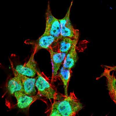 Immunocytochemistry/Immunofluorescence: OCRL Antibody (S166A-26) [NBP2-42193] - Tissue: Neuroblastoma cell line SK-N-BE. Species: Human. Fixation: 4% Formaldehyde for 15 min at RT. Primary Antibody: Mouse Anti-INPP5F Monoclonal Antibody at 1:100 for 60 min at RT. Secondary Antibody: Goat Anti-Mouse ATTO 488 at 1:100 for 60 min at RT. Counterstain: Phalloidin Texas Red F-Actin stain; DAPI (blue) nuclear stain at 1:1000; 1:5000 for 60 min RT, 5 min RT. Localization: Cytoplasmic Vesicle, Endosome, Endosome Membrane, Membrane, Golgi Apparatus, Nucleus. Magnification: 60X.