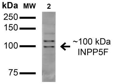 Western Blot: OCRL Antibody (S166A-26) [NBP2-42193] - analysis of Monkey COS cells transfected with GFP-tagged OCRL showing detection of 100 kDa INPP5F protein using Mouse Anti-INPP5F Monoclonal Antibody, Clone S166A-26 . Lane 1: Molecular Weight Ladder. Lane 2: Monkey COS cells transfected with GFP-tagged OCRL. Load: 15 ug . Block: 2% BSA and 2% Skim Milk in 1X TBST. Primary Antibody: Mouse Anti-INPP5F Monoclonal Antibody at 1:200 for 16 hours at 4C. Secondary Antibody: Goat Anti-Mouse IgG: HRP at 1:1000 for 1 hour RT. Color Development: ECL solution for 6 min in RT. Predicted/Observed Size: 100 kDa.