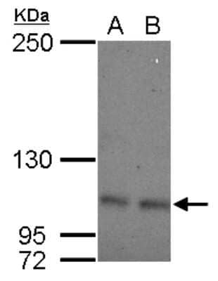 Western Blot: OCRL Antibody [NBP2-19621] - Sample (30 ug of whole cell lysate) A: 293T B: A431 5% SDS PAGE gel, diluted at 1:500.