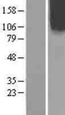 Western Blot: OCRL Overexpression Lysate (Adult Normal) [NBL1-13905] Left-Empty vector transfected control cell lysate (HEK293 cell lysate); Right -Over-expression Lysate for OCRL.