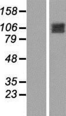 Western Blot: OCRL Overexpression Lysate (Adult Normal) [NBP2-08188] Left-Empty vector transfected control cell lysate (HEK293 cell lysate); Right -Over-expression Lysate for OCRL.