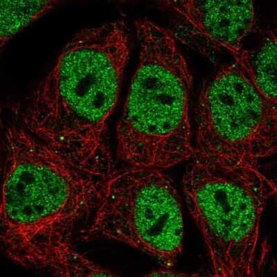 Immunocytochemistry/Immunofluorescence: OCT1 Antibody [NBP2-56190] - Staining of human cell line CACO-2 shows localization to nucleoplasm & vesicles.