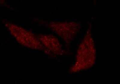 Immunocytochemistry/Immunofluorescence: OCT1 Antibody [NBP3-05865] - Staining of POU2F1 in HeLa cells. Cells were fixed with 4% PFA, permeabilzed with 0.3% Triton X-100 in PBS,blocked with 10% serum, and incubated with rabbit anti-human POU2F1 polyclonal antibody (1:1000) at 4? overnight. Then cells were stained with the Alexa Fluor®594-conjugated Goat Anti-rabbit IgG secondary antibody (red)Positive staining was localized to nucleus.