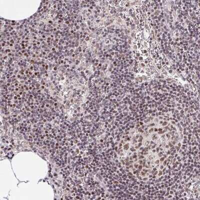 Immunohistochemistry: OCT1 Antibody [NBP2-39024] - Staining of human lymph node shows moderate nuclear  positivity in germinal center cells.