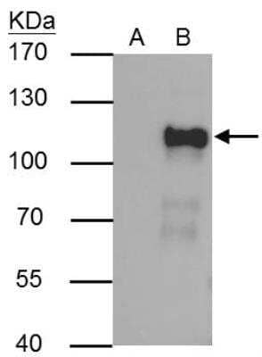 Immunoprecipitation: OCT1 Antibody [NBP2-21584] - 293T whole cell lysate/extract A : Control with 2.5 ug of pre-immune rabbit IgG B : Immunoprecipitation of OCT1 by 2.5 ug of OCT1 antibody 7.5% SDS-PAGE The immunoprecipitated OCT1 protein was detected by OCT1 antibody diluted at 1 : 1000. EasyBlot anti-rabbit IgG (HRP) was used as a secondary reagent.