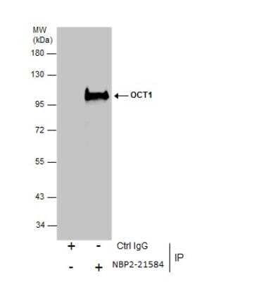 Immunoprecipitation: OCT1 Antibody [NBP2-21584] - Immunoprecipitation of OCT1 protein from 293T whole cell extracts using 5 ug of OCT1 antibody. Western blot analysis was performed using OCT1 antibody. EasyBlot anti-Rabbit IgG was used as a secondary reagent.