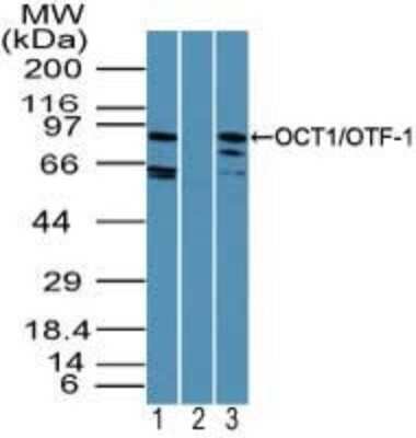 Western Blot: OCT1 Antibody [NBP2-24499] - Analysis of OCT1/OTF1 in Jurkat cell lysate in the 1) absence and 2) presence of immunizing peptide and 3) NIH 3T3 cell lysate using NBP2-24499 at 2 ug/ml, 2 ug/ml and 4 ug/ml respectively. Goat anti-rabbit Ig HRP secondary antibody and PicoTect ECL substrate solution were used for this test.