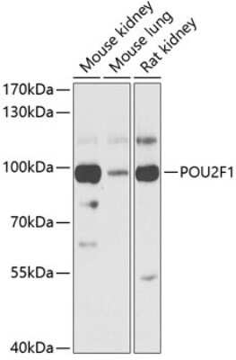 Western Blot: OCT1 Antibody [NBP2-92720] - Analysis of extracts of various cell lines, using 44105 at 1:1000 dilution. Secondary antibody: HRP Goat Anti-Rabbit IgG (H+L) at 1:10000 dilution. Lysates/proteins: 25ug per lane. Blocking buffer: 3% nonfat dry milk in TBST. Detection: ECL Basic Kit . Exposure time: 15s.