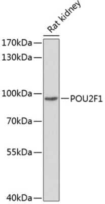 Western Blot: OCT1 Antibody [NBP2-92761] - Analysis of extracts of rat kidney, using 44105 at 1:1000 dilution.Secondary antibody: HRP Goat Anti-Rabbit IgG (H+L) at 1:10000 dilution.Lysates/proteins: 25ug per lane.Blocking buffer: 3% nonfat dry milk in TBST.Detection: ECL Basic Kit .Exposure time: 15s.