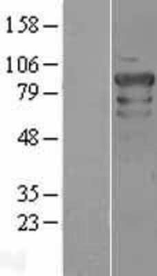 Western Blot OCT1 Overexpression Lysate