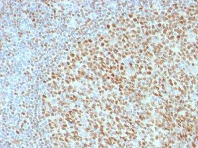 Immunohistochemistry-Paraffin: OCT2 Antibody (Oct2/2136) - Azide and BSA Free [NBP2-75733] - Formalin-fixed, paraffin-embedded human Tonsil stained with Oct-2 Mouse Monoclonal Antibody (OCT2/2136).