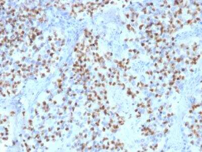 Immunohistochemistry-Paraffin: OCT2 Antibody (Oct2/2136) - Azide and BSA Free [NBP2-75733] - Formalin-fixed, paraffin-embedded human Lymph Node stained with Oct-2 Mouse Monoclonal Antibody (OCT2/2136).