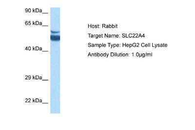 Western Blot: OCTN1/SLC22A4 Antibody [NBP2-87978] - Host: Rabbit. Target Name: SLC22A4. Sample Tissue: Human HepG2 Whole Cell lysates. Antibody Dilution: 1ug/ml