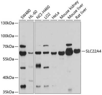 Western Blot: OCTN1/SLC22A4 Antibody [NBP2-94155] - Analysis of extracts of various cell lines, using OCTN1/SLC22A4 at 1:1000 dilution. Secondary antibody: HRP Goat Anti-Rabbit IgG (H+L) at 1:10000 dilution. Lysates/proteins: 25ug per lane. Blocking buffer: 3% nonfat dry milk in TBST. Detection: ECL Basic Kit . Exposure time: 10s.