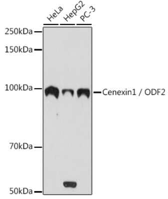 Western Blot: ODF2 Antibody (3Z1H8) [NBP3-16233] - Western blot analysis of extracts of various cell lines, using ODF2 antibody (NBP3-16233) at 1:1000 dilution. Secondary antibody: HRP Goat Anti-Rabbit IgG (H+L) at 1:10000 dilution. Lysates/proteins: 25ug per lane. Blocking buffer: 3% nonfat dry milk in TBST. Detection: ECL Basic Kit. Exposure time: 10s.