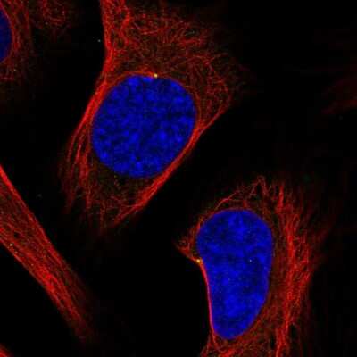 Immunocytochemistry/Immunofluorescence: ODF2 Antibody [NBP2-58793] - Staining of human cell line U-2 OS shows localization to centrosome. Antibody staining is shown in green.