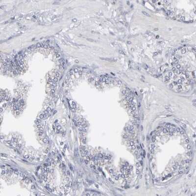 <b>Orthogonal Strategies Validation. </b>Immunohistochemistry-Paraffin: ODF2 Antibody [NBP1-85417] - Staining of human prostate shows low expression as expected.