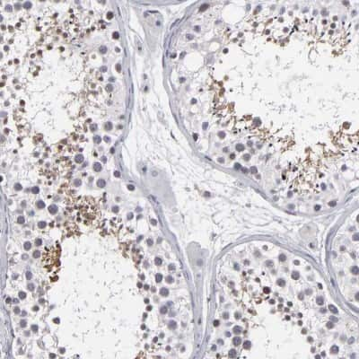 Immunohistochemistry-Paraffin: ODF2 Antibody [NBP1-85417] - Staining of human testis shows high expression.